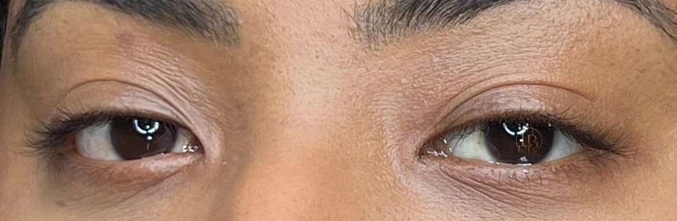 Antes: olhos sem extensão de cílios